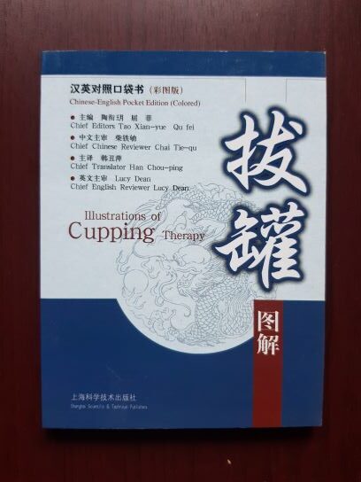 Illustrations of Cupping Therapy